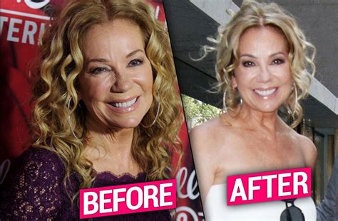 kathie lee gifford boobs|Kathy Lee Gifford’s Plastic Surgery: What Procedures Did Kathie Lee ...